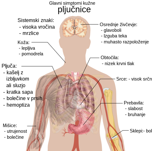 Nizak krvni tlak (hipotenzija) – uzroci, simptomi i liječenje