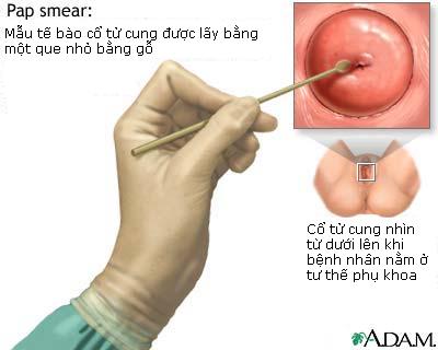 Tập tin:Phet tb ctc.JPG