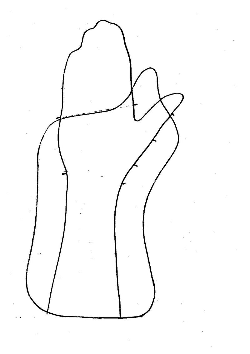 File:Templates for Hand and Wrist Hand Orthoses.pdf