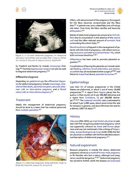 File:Insights into abdominal pregnancy.pdf