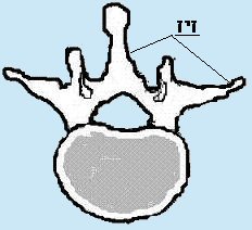 קובץ:vertebra.jpg